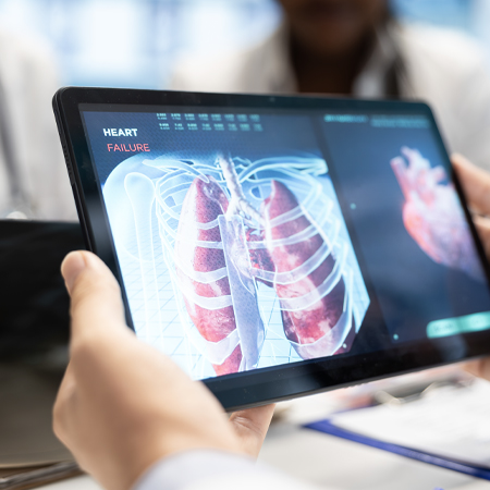 Médico revisando un estudio digital de los pulmones para el diagnóstico preciso de asma, evaluación de tos persistente y secuelas de covid en Tlalnepantla de Baz.